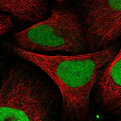 Immunocytochemistry/Immunofluorescence: Kif4A Antibody [NBP1-83721] - Immunofluorescent staining of human cell line U-2 OS shows localization to nucleoplasm.