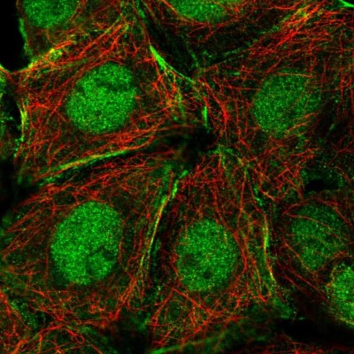 Immunocytochemistry/Immunofluorescence: NCOA5 Antibody [NBP2-47361] - Immunofluorescent staining of human cell line MCF7 shows localization to nucleoplasm & actin filaments.