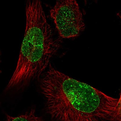 Immunocytochemistry/Immunofluorescence: KIAA1586 Antibody [NBP1-86291] - Immunofluorescent staining of human cell line U-251 MG shows localization to nuclear membrane.