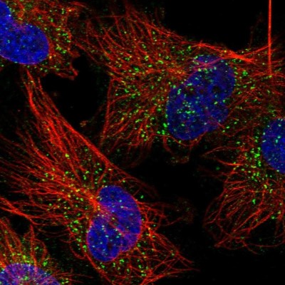 Immunocytochemistry/Immunofluorescence: Glycogenin 1 Antibody [NBP1-89723] - Immunofluorescent staining of human cell line U-251 MG shows localization to vesicles.