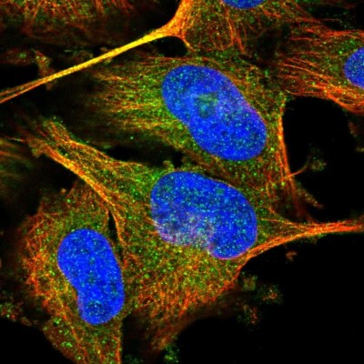 Immunocytochemistry/Immunofluorescence: NARG1 Antibody [NBP1-92165] - Immunofluorescent staining of human cell line U-251 MG shows localization to cytosol.