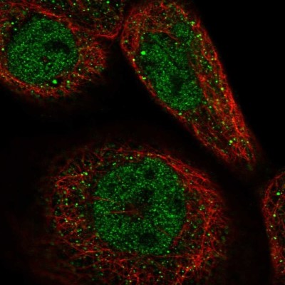 Immunocytochemistry/Immunofluorescence: CCDC113 Antibody [NBP2-14443] - Staining of human cell line A-431 shows localization to nucleoplasm & cytosol.