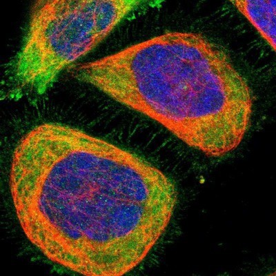 Immunocytochemistry/Immunofluorescence: SARG Antibody [NBP1-83487] - Staining of human cell line A-431 shows positivity in plasma membrane and cytoplasm.