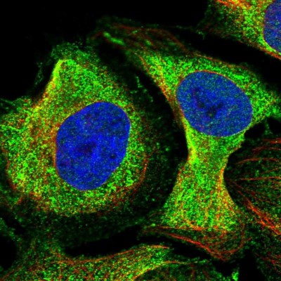 Immunocytochemistry/Immunofluorescence: NDUFAF1 Antibody [NBP1-84503] - Immunofluorescent staining of human cell line U-2 OS shows localization to cytosol.