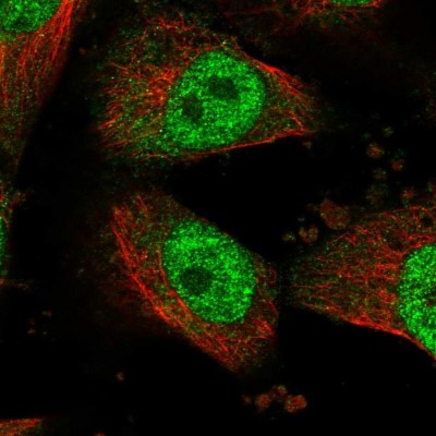 Immunocytochemistry/Immunofluorescence: HECTD2 Antibody [NBP1-83481] - Immunofluorescent staining of human cell line U-251 MG shows localization to nucleoplasm.