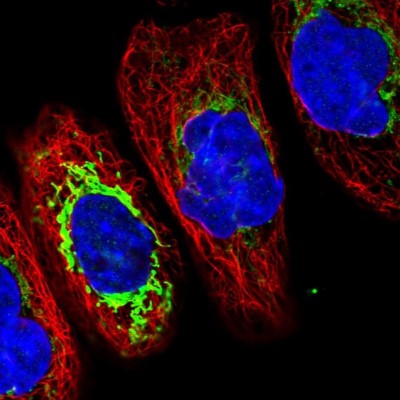 Immunocytochemistry/Immunofluorescence: TMCO6 Antibody [NBP1-83463] - Immunofluorescent staining of human cell line A-431 shows localization to mitochondria.