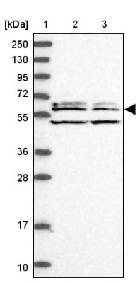 Western Blot: C2orf44 Antibody [NBP1-83612] - Lane 1: Marker  [kDa] 250, 130, 95, 72, 55, 36, 28, 17, 10.  Lane 2: Human cell line RT-4.  Lane 3: Human cell line U-251MG sp