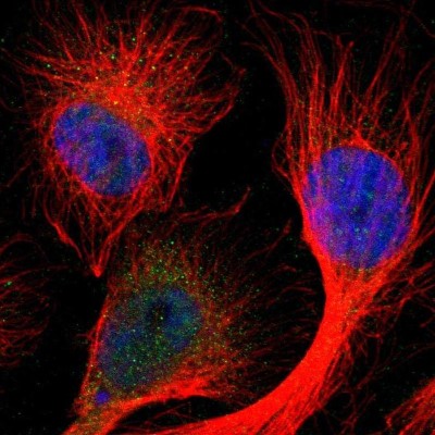 Immunocytochemistry/Immunofluorescence: GLIS1 Antibody [NBP1-83492] - Staining of human cell line U-251MG shows positivity in nucleus but not nucleoli and cytoplasm.