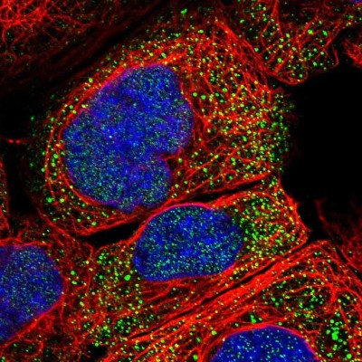 Immunocytochemistry/Immunofluorescence: PDP1/PPAPDC2 Antibody [NBP1-83443] - Immunofluorescent staining of human cell line A-431 shows localization to nucleoplasm & vesicles.