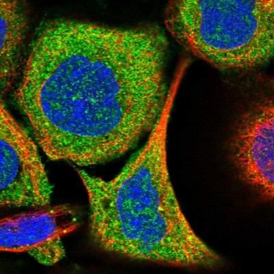 Immunocytochemistry/Immunofluorescence: ABHD13 Antibody [NBP2-38205] - Immunofluorescent staining of human cell line A-431 shows localization to cytosol.
