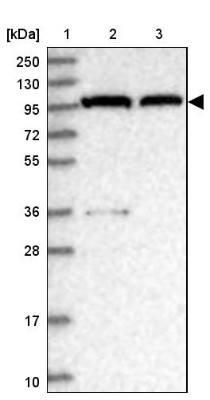 Western Blot: CSE1L/CAS/Exportin-2 Antibody [NBP2-38383] - Lane 1: Marker  [kDa] 250, 130, 95, 72, 55, 36, 28, 17, 10.  Lane 2: Human cell line RT-4.  Lane 3: Human cell line U-251MG
