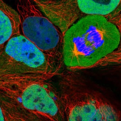 Immunocytochemistry/Immunofluorescence: CSE1L/CAS/Exportin-2 Antibody [NBP2-38383] - Staining of human cell line CACO-2 shows localization to nucleoplasm & cytosol.