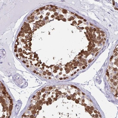 Immunohistochemistry: CSE1L/CAS/Exportin-2 Antibody [NBP2-38383] - Staining of human testis shows strong nuclear and cytoplasmic positivity in cells in seminiferous duct.