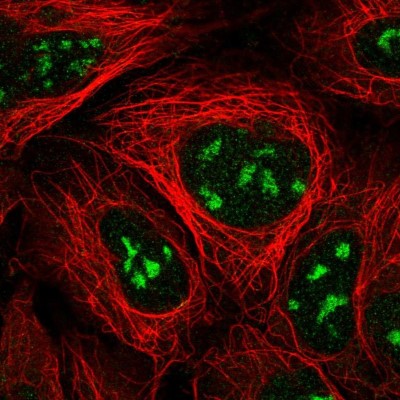 Immunocytochemistry/Immunofluorescence: NVL Antibody [NBP2-37861] - Immunofluorescent staining of human cell line HEK 293 shows localization to nucleoli.