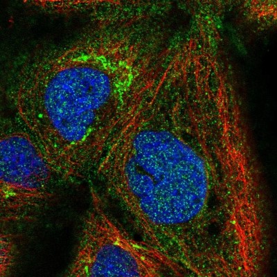 Immunocytochemistry/Immunofluorescence: PSMG1 Antibody [NBP2-33820] - Immunofluorescent staining of human cell line A-431 shows localization to cytosol & the Golgi apparatus.