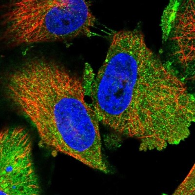 Immunocytochemistry/Immunofluorescence: TPD52L1/D53 Antibody [NBP1-84313] - Staining of human cell line U-251 MG shows localization to plasma membrane, cytosol & cell junctions.