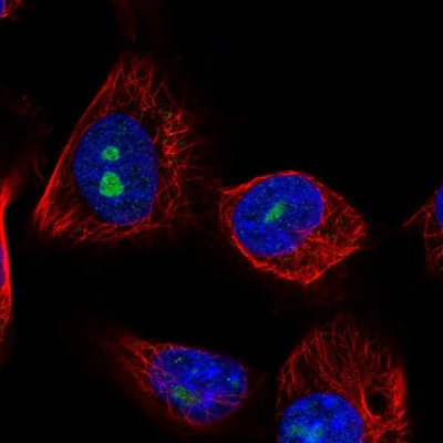 Immunocytochemistry/Immunofluorescence: LRRC23 Antibody [NBP1-88962] - Immunofluorescent staining of human cell line U-251 MG shows localization to nucleoli.