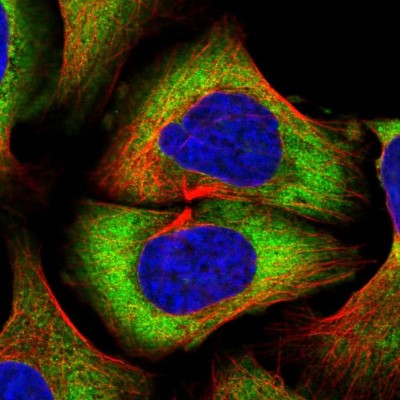 Immunocytochemistry/Immunofluorescence: PABPC4 Antibody [NBP2-13722] - Immunofluorescent staining of human cell line U-2 OS shows localization to cytosol.
