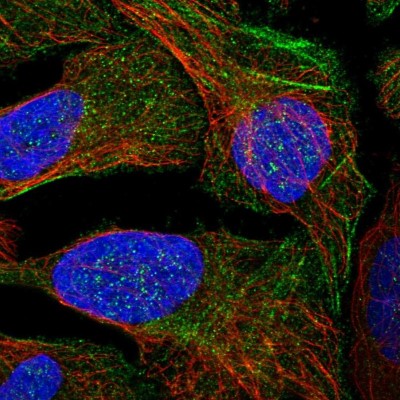 Immunocytochemistry/Immunofluorescence: LYSMD4 Antibody [NBP1-83511] - Immunofluorescent staining of human cell line U-2 OS shows localization to cytosol & actin filaments.