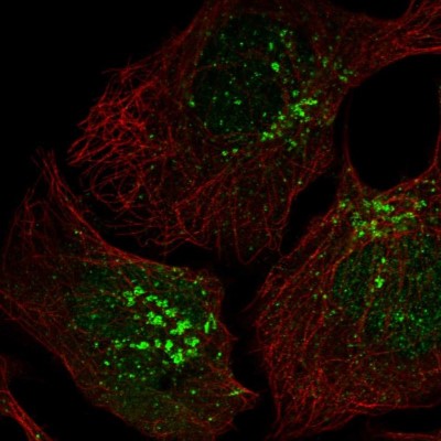 Immunocytochemistry/Immunofluorescence: CCDC25 Antibody [NBP1-83821] - Immunofluorescent staining of human cell line U-2 OS shows localization to nucleoplasm & the Golgi apparatus.