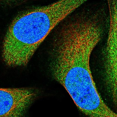 Immunocytochemistry/Immunofluorescence: ANKRD50 Antibody [NBP1-93594] - Immunofluorescent staining of human cell line U-2 OS shows localization to nucleoplasm & cytosol.