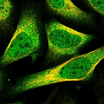 Immunocytochemistry/Immunofluorescence: CGI-128 Antibody [NBP1-88091] - Immunofluorescent staining of human cell line U-2 OS shows localization to nucleoplasm & cytosol.