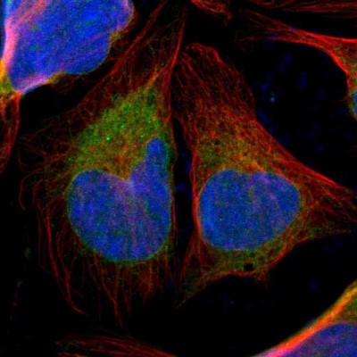 Immunocytochemistry/Immunofluorescence: TXNDC Antibody [NBP1-87306] - Immunofluorescent staining of human cell line U-2 OS shows localization to nucleoli & endoplasmic reticulum.