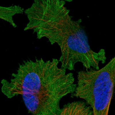 Immunocytochemistry/Immunofluorescence: KNTC1 Antibody [NBP1-83032] - Immunofluorescent staining of human cell line U-251 MG shows localization to plasma membrane, cytosol & actin filaments.