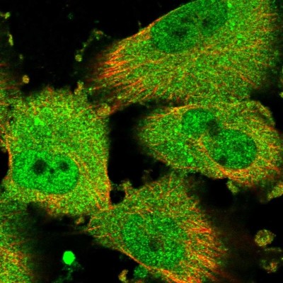 Immunocytochemistry/Immunofluorescence: CHML Antibody [NBP1-87142] - Immunofluorescent staining of human cell line U-251 MG shows localization to nucleoplasm & cytosol.