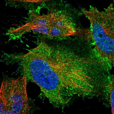 Immunocytochemistry/Immunofluorescence: TYW3 Antibody [NBP1-88492] - Immunofluorescent staining of human cell line U-251 MG shows localization to plasma membrane & cytosol.