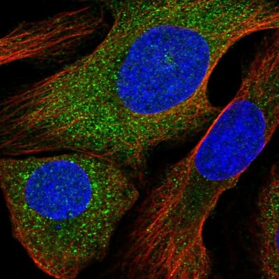 Immunocytochemistry/Immunofluorescence: ALOX12B Antibody [NBP1-89409] - Immunofluorescent staining of human cell line U-2 OS shows localization to cytosol.