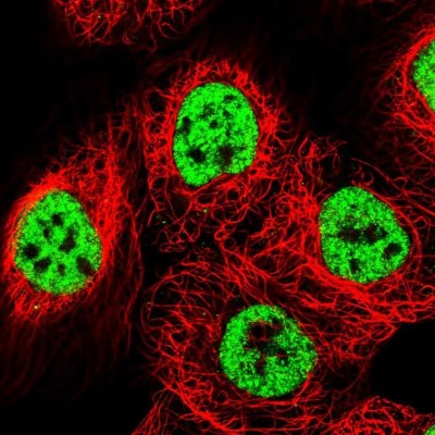 Immunocytochemistry/Immunofluorescence: BTF Antibody [NBP1-89924] - Staining of human cell line A-431 shows localization to nuclear speckles.