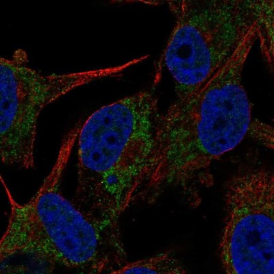 Immunocytochemistry/Immunofluorescence: TYKi Antibody [NBP1-80653] - Staining of human cell line SK-MEL-30 shows localization to mitochondria.