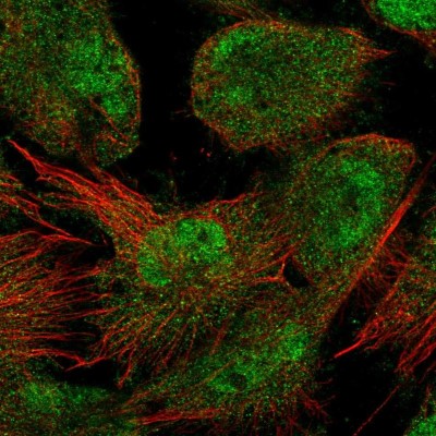 Immunocytochemistry/Immunofluorescence: Fbl14 Antibody [NBP2-33296] - Immunofluorescent staining of human cell line U-251 MG shows localization to nucleoplasm & cytosol.