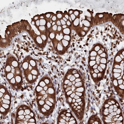 Immunocytochemistry/Immunofluorescence: PIGN Antibody [NBP1-81249] - Staining of human rectum shows strong cytoplasmic positivity in glandular cells.