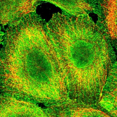 Immunocytochemistry/Immunofluorescence: CCDC97 Antibody [NBP1-91767] - Immunofluorescent staining of human cell line A-431 shows localization to nucleoplasm, plasma membrane & cytosol.