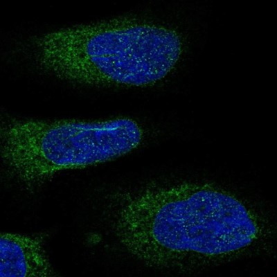 Immunocytochemistry/Immunofluorescence: DDOST Antibody [NBP2-38560] - Immunofluorescent staining of human cell line U-2 OS shows localization to endoplasmic reticulum.