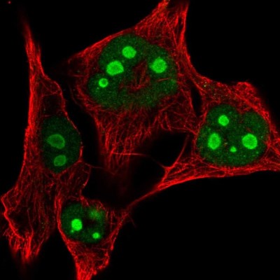 Immunocytochemistry/Immunofluorescence: RPL24/RLP24 Antibody [NBP2-38971] - Immunofluorescent staining of human cell line SK-MEL-30 shows localization to nucleus & nucleoli.