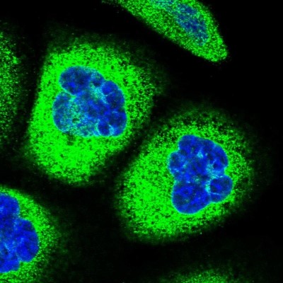 Immunocytochemistry/Immunofluorescence: CYP51A1 Antibody [NBP2-48733] - Immunofluorescent staining of human cell line A-431 shows localization to endoplasmic reticulum.