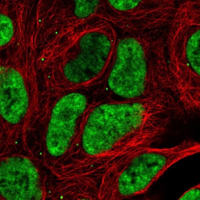 Immunocytochemistry/Immunofluorescence: DDX17 Antibody [NBP2-38985] - Immunofluorescent staining of human cell line HEK 293 shows localization to nuclear speckles.