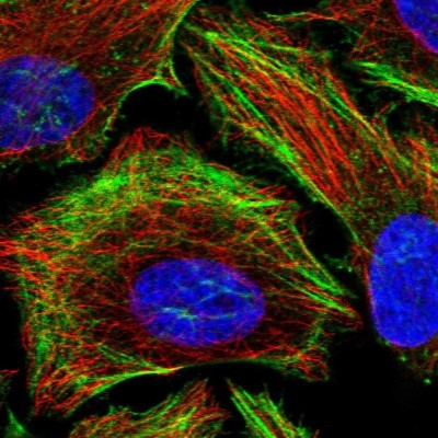 Immunocytochemistry/Immunofluorescence: LIMCH1 Antibody [NBP2-39006] - Staining of human cell line HeLa shows localization to actin filaments.