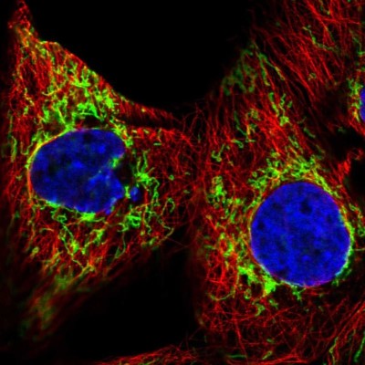 Immunocytochemistry/Immunofluorescence: GBAS Antibody [NBP2-38984] - Immunofluorescent staining of human cell line A-431 shows localization to mitochondria.