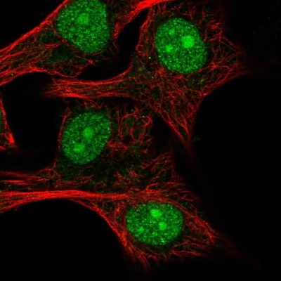 Immunocytochemistry/Immunofluorescence: RPL24/RLP24 Antibody [NBP2-38992] - Immunofluorescent staining of human cell line SK-MEL-30 shows localization to nucleus & nucleoli.