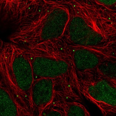 Immunocytochemistry/Immunofluorescence: TIPIN Antibody [NBP2-38860] - Immunofluorescent staining of human cell line HEK 293 shows localization to nucleus & vesicles.