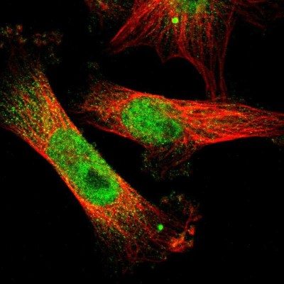 Immunocytochemistry/Immunofluorescence: ETV3 Antibody [NBP1-80931] - Immunofluorescent staining of human cell line U-251 MG shows localization to nucleoplasm.
