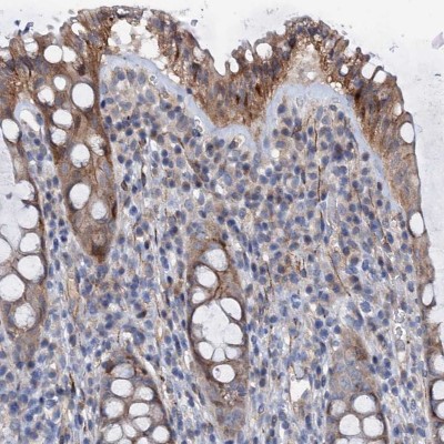 Immunocytochemistry/Immunofluorescence: PAMCI Antibody [NBP1-80938] - Staining of human rectum shows moderate cytoplasmic positivity in glandular cells.