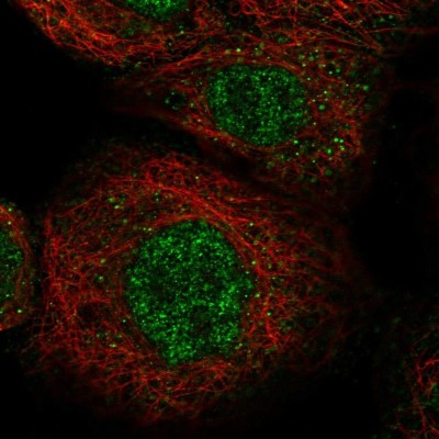 Immunocytochemistry/Immunofluorescence: LYSMD1 Antibody [NBP1-81095] - Immunofluorescent staining of human cell line A-431 shows localization to nucleoplasm.