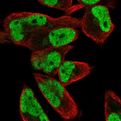 Immunocytochemistry/Immunofluorescence: FEM1C Antibody [NBP2-32501] - Immunofluorescent staining of human cell line RH-30 shows localization to nucleoplasm.