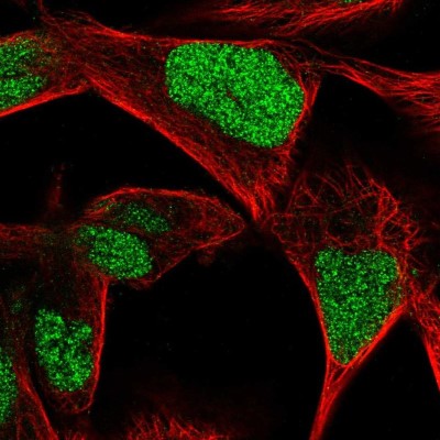 Immunocytochemistry/Immunofluorescence: CGGBP1 Antibody [NBP2-32680] - Immunofluorescent staining of human cell line RH-30 shows localization to nucleus.