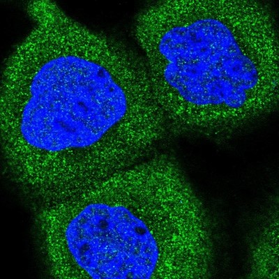 Immunocytochemistry/Immunofluorescence: SAPS1 Antibody [NBP2-48803] - Analysis of human cell line A-431 shows positivity in cytoplasm.